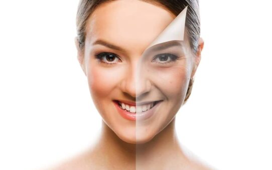 Chemical Skin Peels: Chemical Skin Peels ..and how to use them effectively